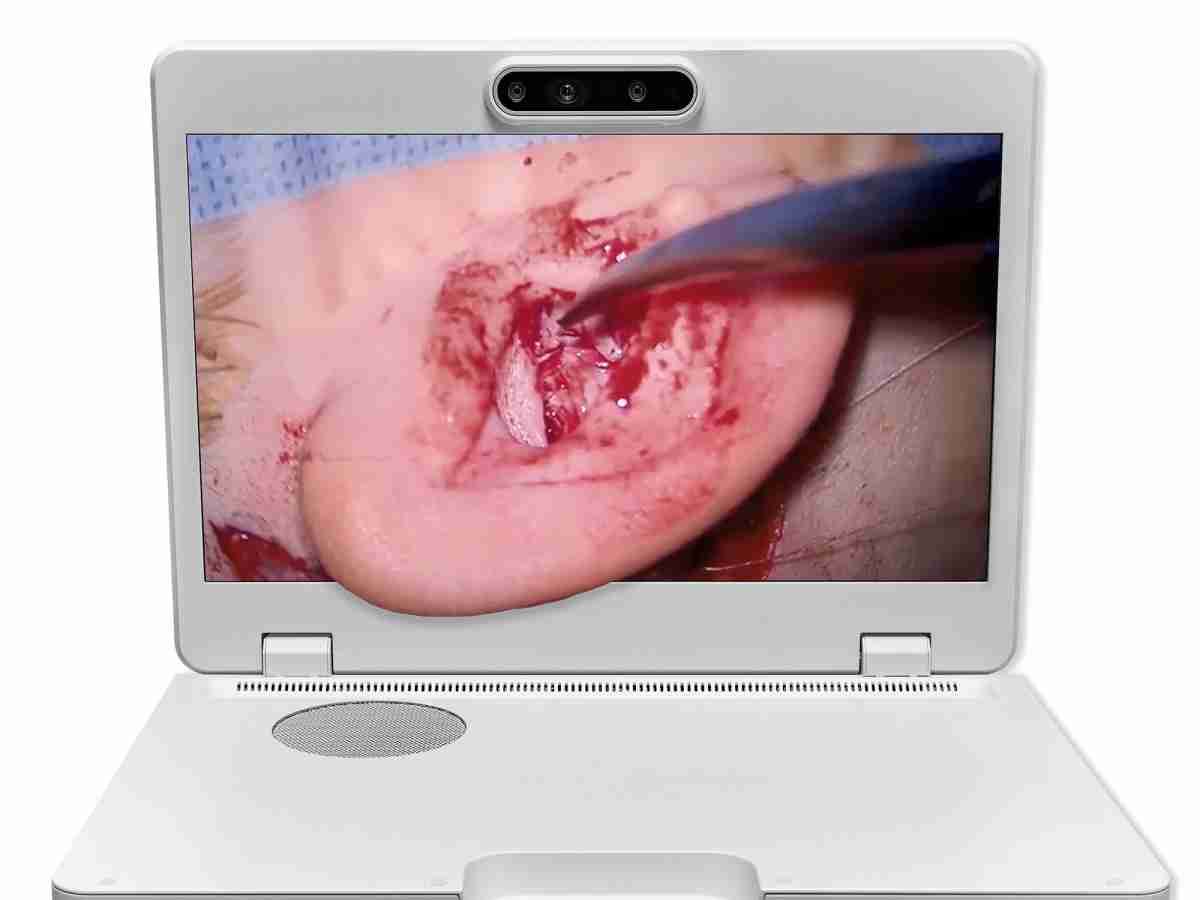 达擎之＂Heads-up 3D显微手术显示系统＂，，，整合4K裸眼3D显示及眼球追踪系统，，具备快速追踪人眼移动位置功能，，减轻医师长时间维持固定姿势的负担，，让医师能有更宽广清晰的3D立体视野及更舒适的姿势来执行手术。。。